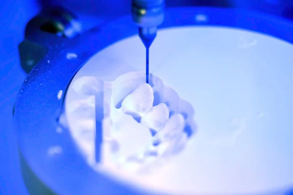 Diş değirmeni makinesi insan dişlerini oyuyor.