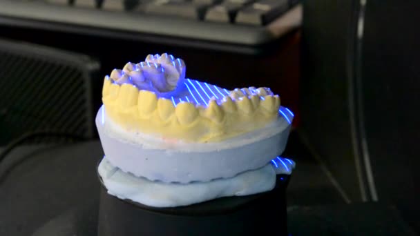 3D Scanning a model of human teeth close-up — Stock Video