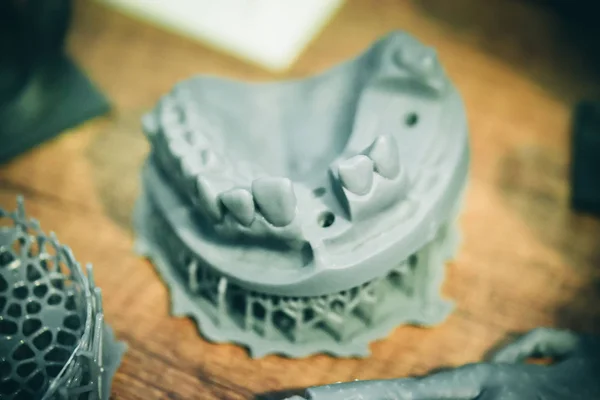 Bir adamın alt çenesi, bir fotopolimer materyalden 3d yazıcıda oluşturuldu