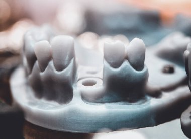 Diş ve implant taç abutment için delikleri daraltılabilir çene model 3d bir yazıcıda yazdırılan