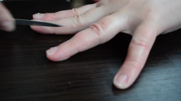 손톱을 — 비디오