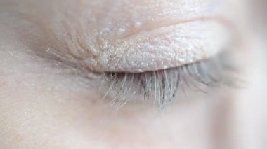 Dişi gözü. Bak ve gör.