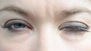 Gözlerinde kirpikleri var. Gözlere bak.