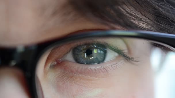 Olhos Sobrancelhas Pontos Nos Olhos — Vídeo de Stock