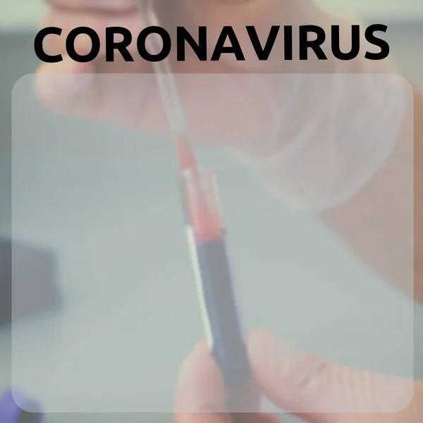 Coronavirus 2019 Ncov Nuovo Concetto Coronavirus Reposibile Influenza Asiatica Coronavirus — Foto Stock