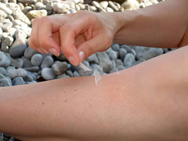 The hand pulls off a small thin transparent piece of skin after sunburn. Real photo, close-up of hands without manicure on the background of large sea pebbles.