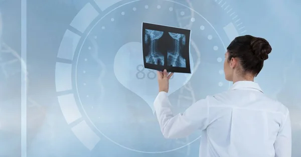 Lekarz (kobiety) poszukuje fotografii rentgenowskiej — Zdjęcie stockowe