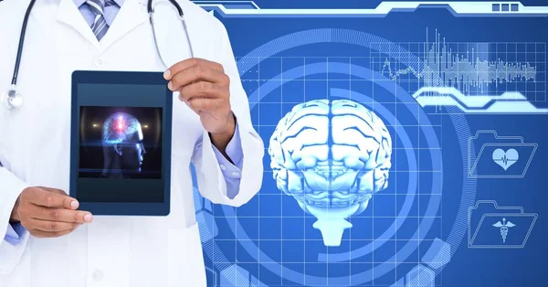 Лікар, що показує людський мозок — стокове фото
