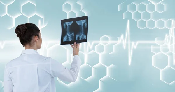 Vue arrière du médecin féminin tenant un rapport de rayons X contre l'interface — Photo