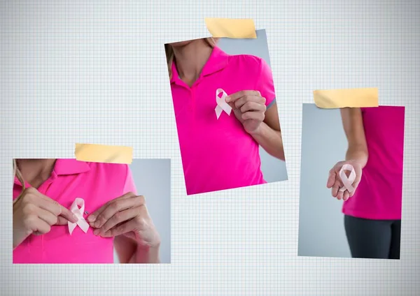 여자와 유 방 암 인식 콜라주 — 스톡 사진