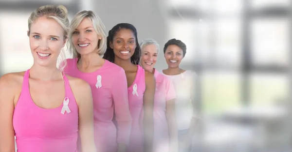 Mulheres com câncer de mama com transição de janelas — Fotografia de Stock