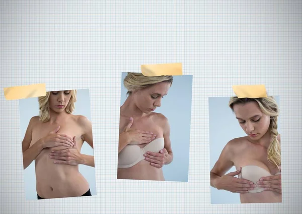 Collage di consapevolezza del cancro al seno con la donna — Foto Stock