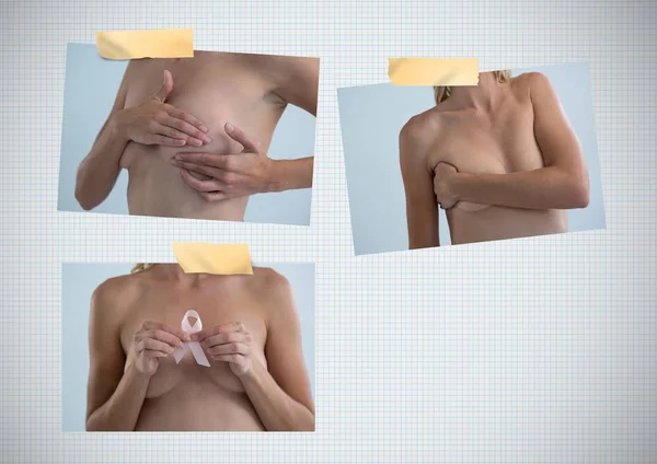 Collage di consapevolezza del cancro al seno con la donna — Foto Stock