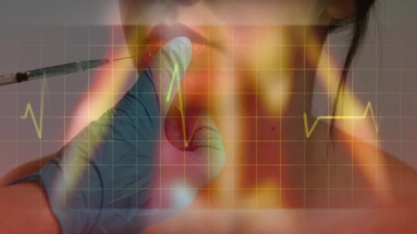 Анимация Частоты Сердцебиения Данных Сетке Движущейся Вблизи Женского Тела Пациента — стоковое видео