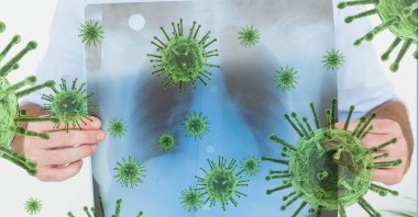 Arka planda yüzen makro Coronavirus Covid-19 hücreleri üzerinde akciğerlerinin röntgen taramasını tutan kişinin dijital çizimi. Halk sağlığı salgını Coronavirus Covid 19 salgın konsepti dijital bileşik.