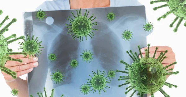 Digital Illustration Woman Holding Ray Photo Her Chest Macro Coronavirus — Stock Photo, Image