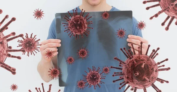 Цифровая Иллюстрация Человека Держащего Рентгеновское Сканирование Своей Груди Над Макрокоронавирусами — стоковое фото