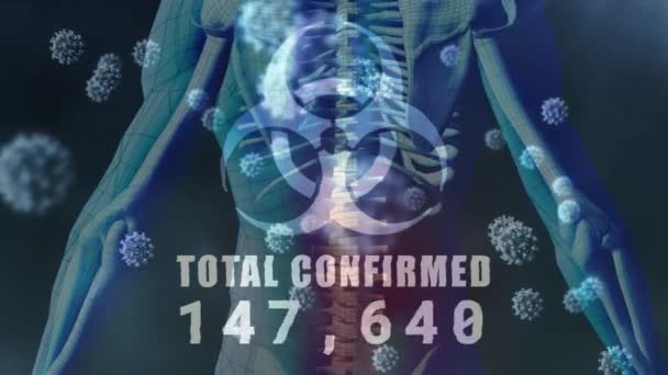 一个蓝色危险标志的数字图像 总确认数上升 宏观Covid 19细胞漂浮在三维人体骨骼模型之上 Coronavirus Covid 19大流行病概念数字组合 — 图库视频影像