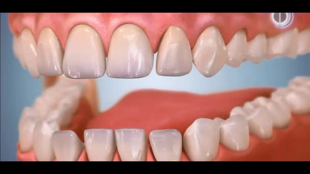 3D zubní video - stoličky - zuby moudrosti 7