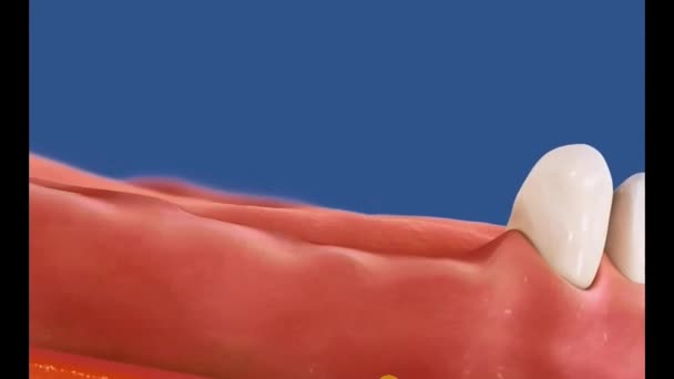 Zahnärztliches 3D-Video - Unterer Posterior 3 