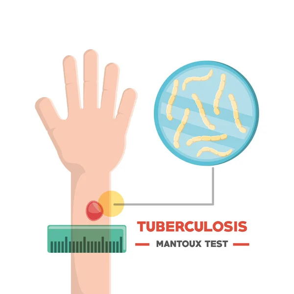 Tubereculosis 컨셉 디자인 — 스톡 벡터