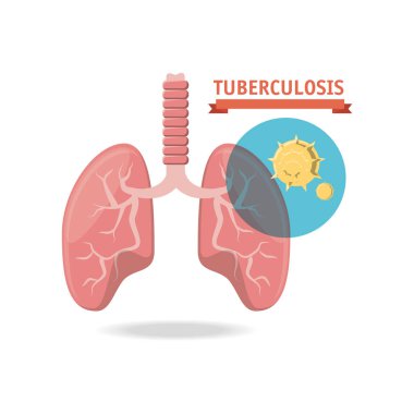 Tubereculosis konsept tasarımı