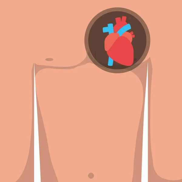 Ağrı göğüs ve kalp krizi belirtileri — Stok Vektör