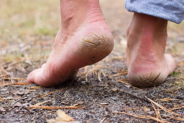 Kırık topuklu fotoğraf çifti kadar kapatın. Erkek arkadan görünüm.