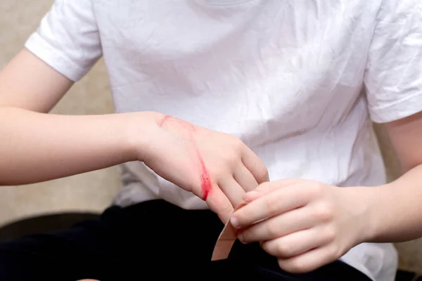 Çocuk, acının arka planına karşı güçlü duygular hissediyor..