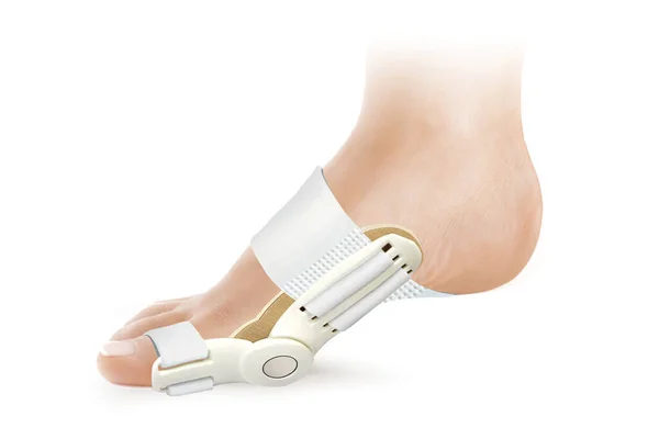 Hallux Valgus Ortopedik Tıbbi Başparmak Kolu beyaz arka planda izole edildi. Ayak parmakları için ortopediler.