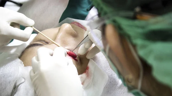 Cerrar Proceso Los Párpados Cirugía Belleza Industria Médica —  Fotos de Stock