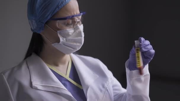 Un microbiólogo comprueba un tubo de ensayo con la sangre del paciente en el que hay una pegatina de COVID 19. La doctora está cansada durante el coronavirus pandémico. De cerca. Prores 422 — Vídeos de Stock