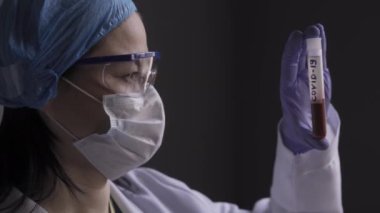 Doktor laboratuvar teknisyeni COVID 19 'da hasta olan bir hastanın kan testini test ediyor. Hastane konsepti. Kapatın. Prores 422