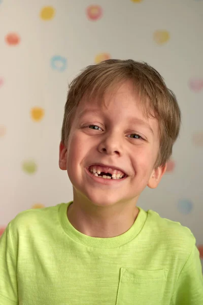 Niño Años Mostrando Dientes Perdidos Perdido Dos Dientes Ternera Primer — Foto de Stock