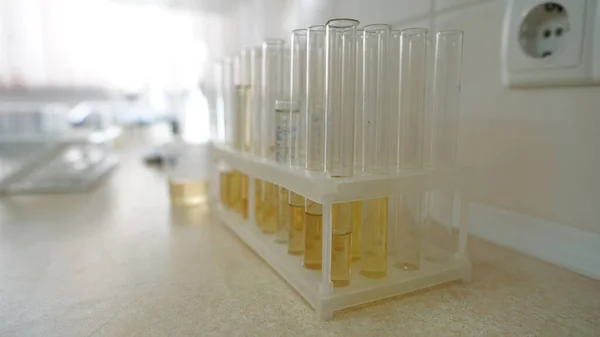 Zestaw Probówek Zbliżeniem Osocza Krwi Laboratorium Plastikowym Uchwycie Pudełko Epidemia — Zdjęcie stockowe