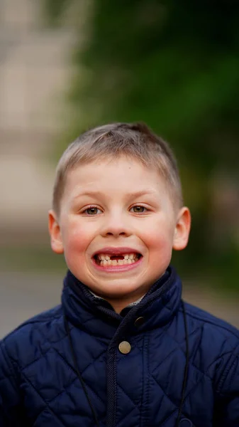 Retrato Rapaz Com Dentes Frente Caídos Bebê Mostra Lacuna Entre — Fotografia de Stock