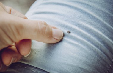 İnsan pantolonunda sinir bozucu bir kene böceği, parmağıyla işaret ediyor. Hafif giysiler giy ki ormana giderken kolayca fark edebilesin. Borrelioz ve beyin iltihabı taşıyor..