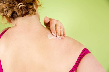 Boyunda ağrı kesici krem süren boynu ağrıyan genç bir kadın. Boyun ağrısı konsepti. Boyun ağrısını hafifletiyor..