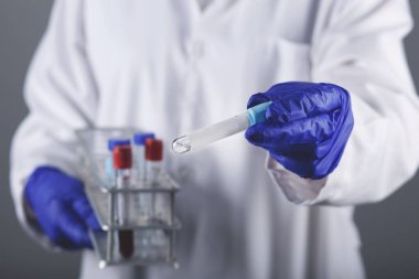 Kadın doktorun elinde kan testi sonucu var.
