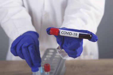Doktor elle yapılan Coronavirus kan testi sonuçları.