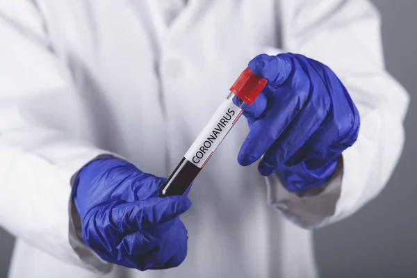 Lékař Ruční Krevní Testy Pro Coronavirus — Stock fotografie