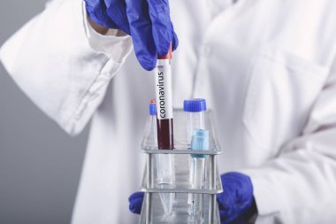 Doktorun eli bir test tüpünde kan tutuyor.