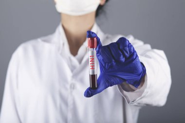 H1N1 için doktor el kanı testi sonucu.