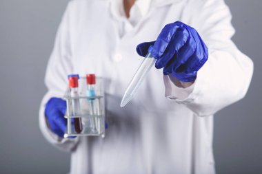 Kadın doktorun elinde kan testi sonucu var.