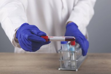 Doktor elle yapılan Coronavirus kan testi sonuçları.