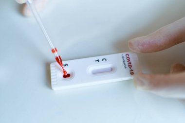 Viral hastalık için eldiven giyen doktor COVID-19, 2019 nCoV, laboratuvar kartı testine kan damlatıyor. Test kiti negatif sonuç gösteriyor.