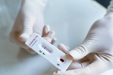 Doktor, viral hastalık COVID-19, 2019-NCoV için eldiven taşıyor. Test negatif sonuç veriyor. Koronavirüs teşhisi.