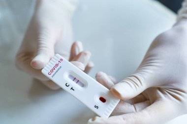 Doktor, viral hastalık COVID-19, 2019-NCoV için eldiven taşıyor. Test pozitif sonuç veriyor. Koronavirüs teşhisi.