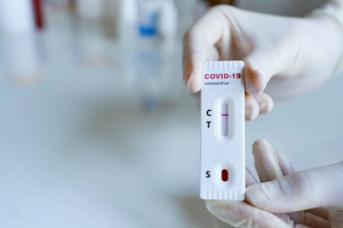Ellerinde negatif COVID-19 testi, Coronavirus enfeksiyonu teşhisi için hızlı test kiti bulunan eldivenler var.