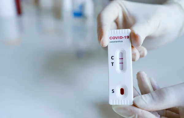 Ellerinde COVID-19 testi, Coronavirus enfeksiyonu teşhisi için hızlı test kiti bulunan eldivenler var.